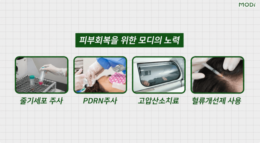 모발이식 후 생착을 돕기위한 모디헤어플란트의 프로그램들