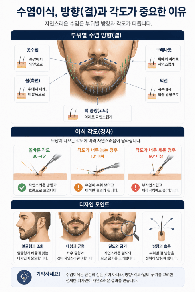 수염이식에서 중요한 모낭 방향과 각도 디자인