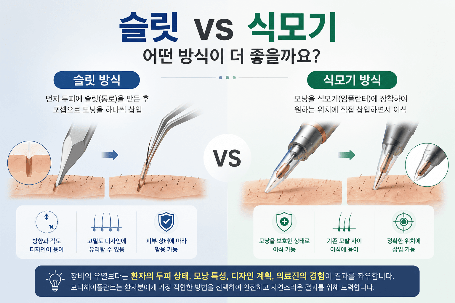모발이식 슬릿 방식과 식모기 방식 비교