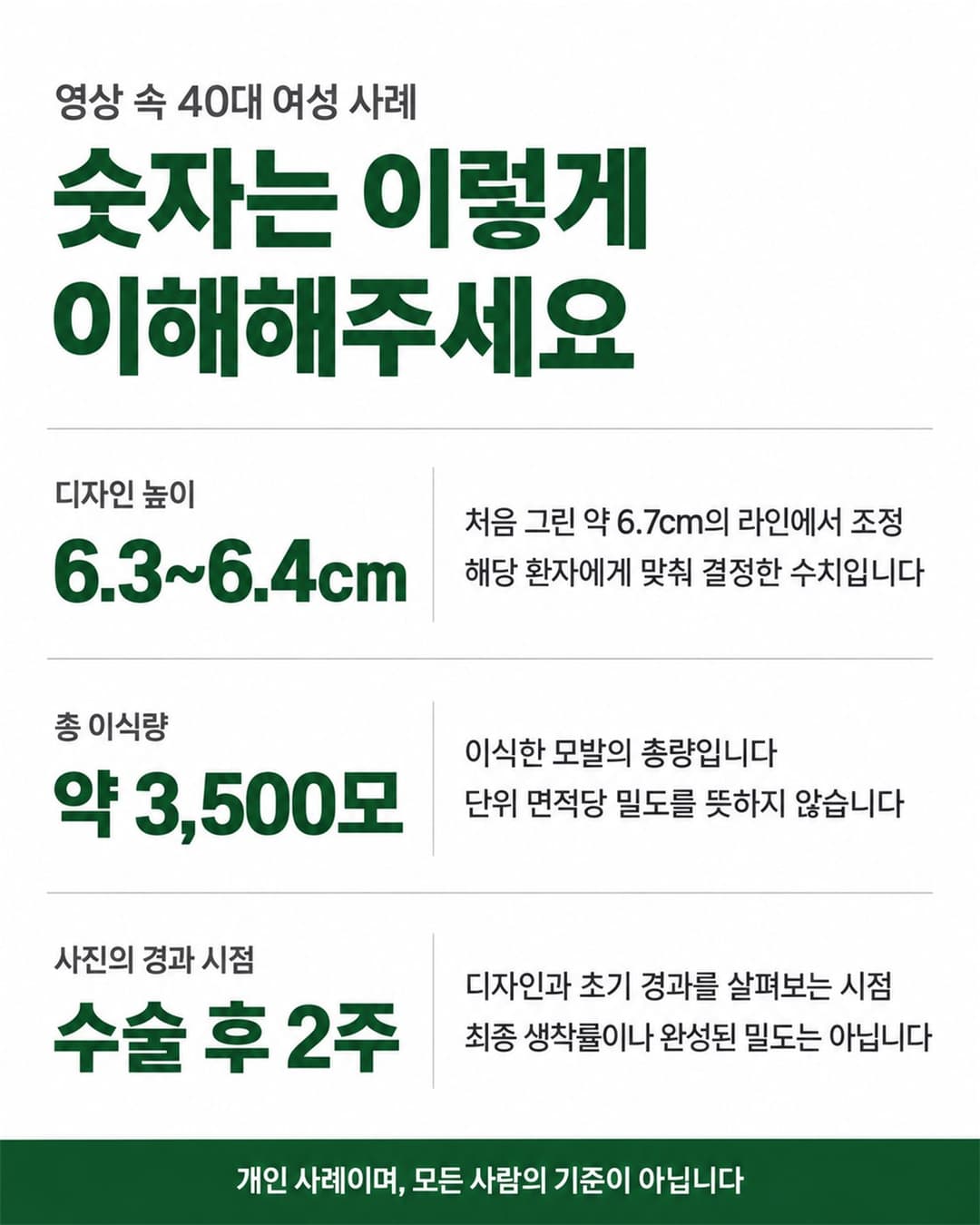 40대 여성 헤어라인 사례의 디자인 높이 조정과 약 3500모 이식 계획 요약