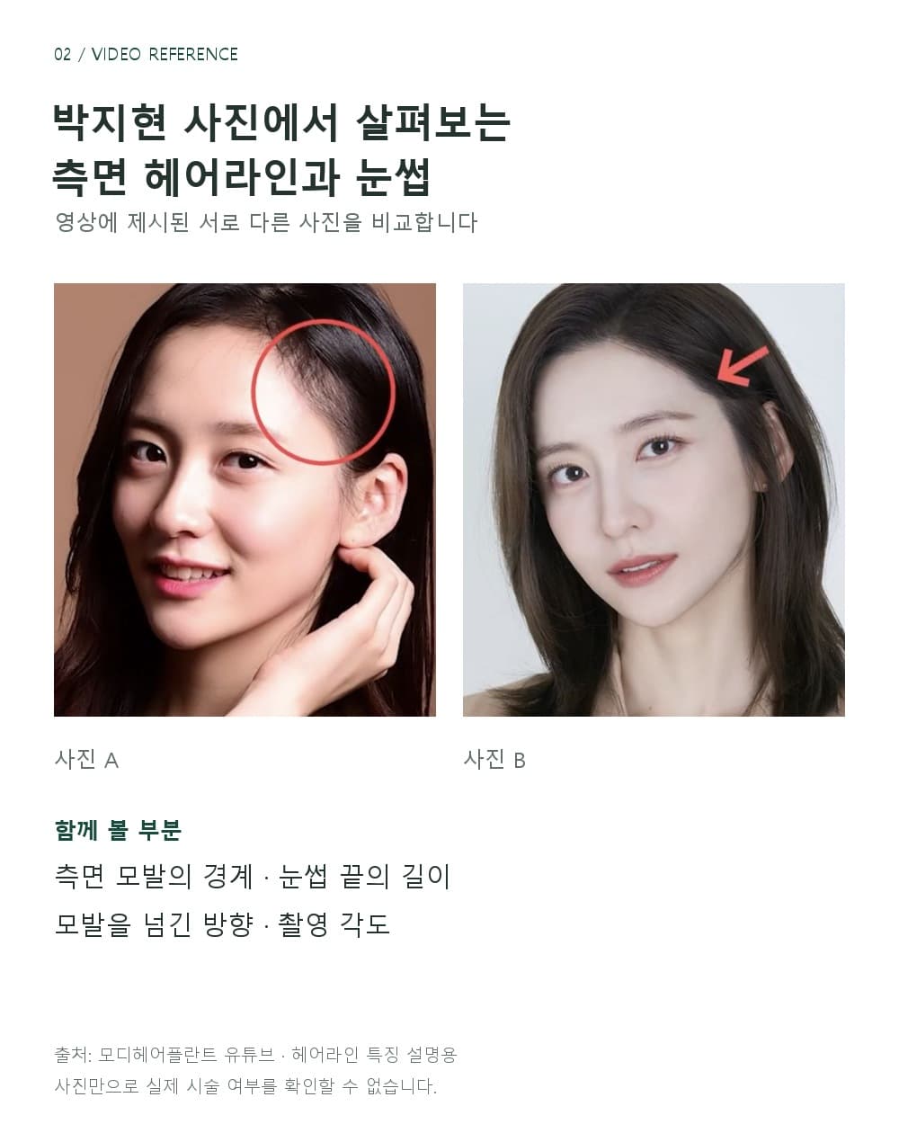 영상에 제시된 박지현 배우의 두 사진에서 측면 모발 경계와 눈썹 끝의 위치를 비교하는 이미지