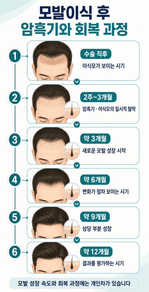 모발이식 암흑기와 3개월 6개월 9개월 12개월 회복 과정